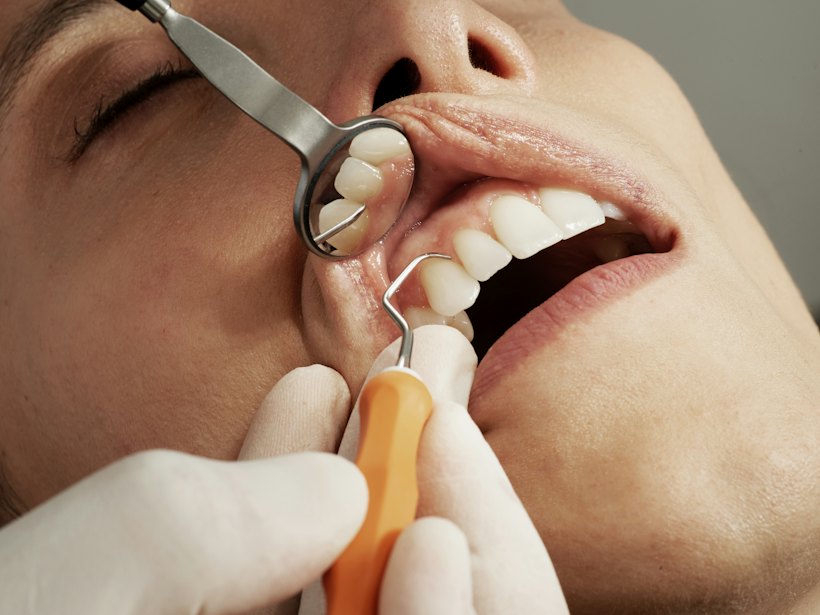 Representative dental imagery